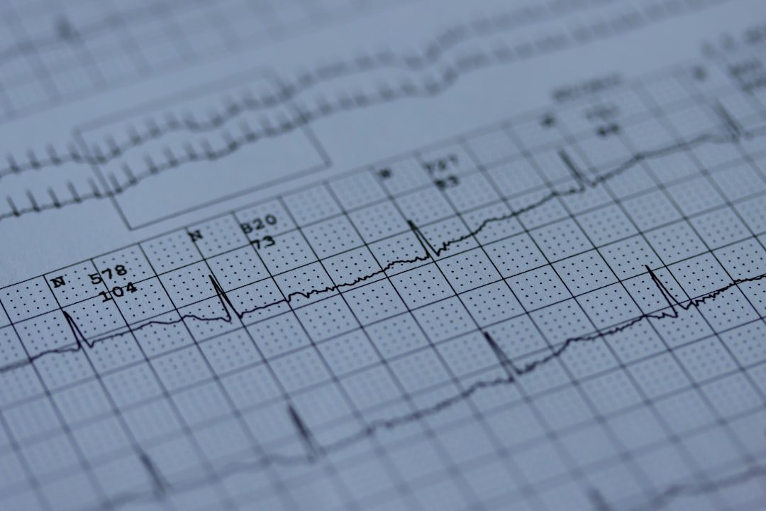 Yapay zeka, EKG'yi iki saniyede okuyarak kalp hastalıklarını tespit ediyor